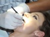 How to Save Money on Dental Bills Know About How To Save the Money On Dental Bills